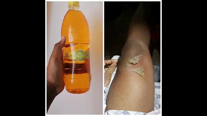 Yellow peeling oil before- after/ Huile de peeling avant et après